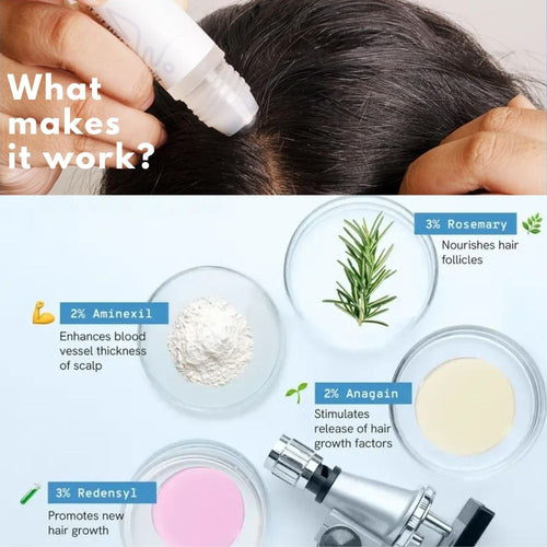 ScalpRevive® Growth Serum Roll-On
